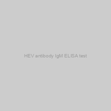 Image of HEV antibody IgM ELISA test